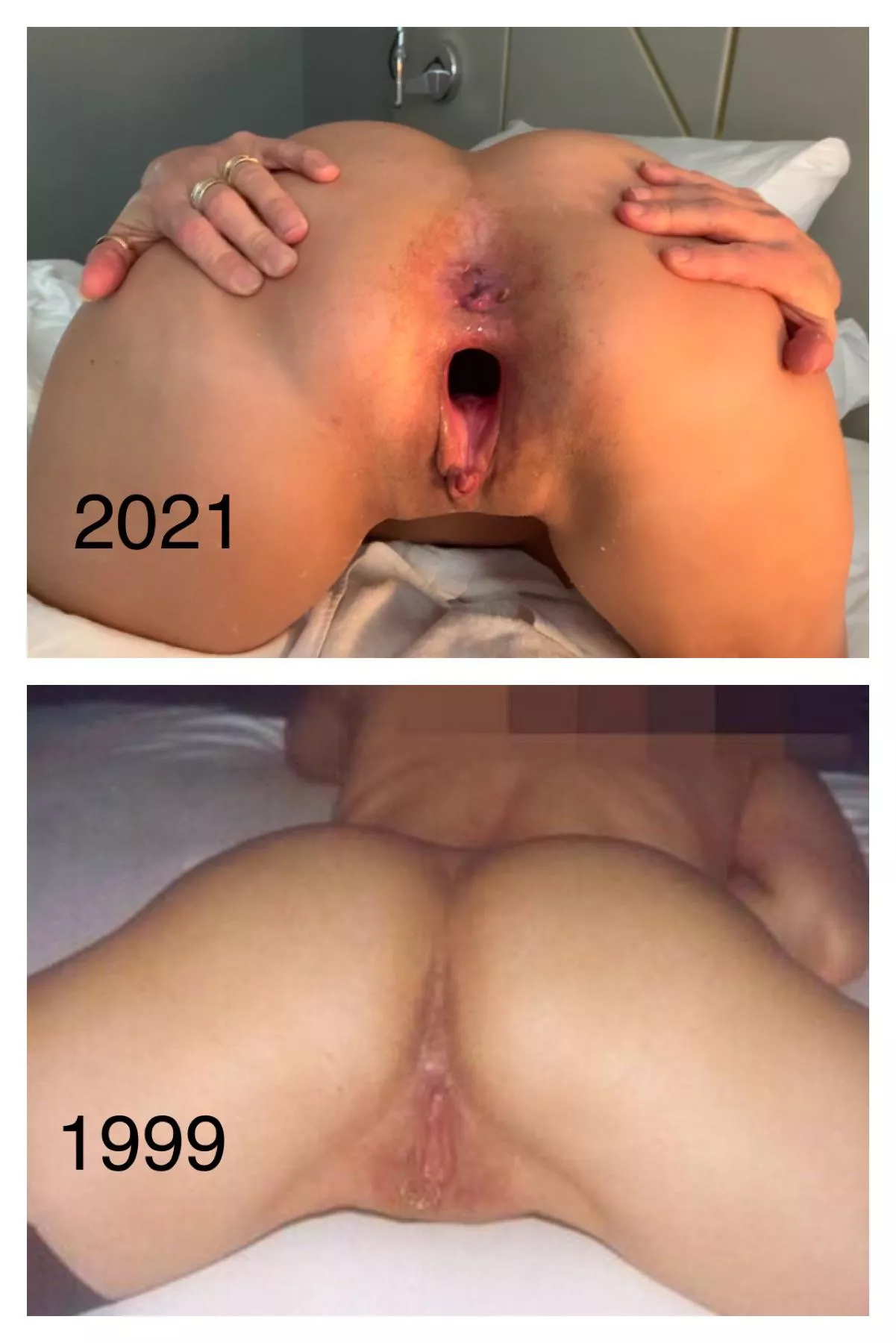 After 22 Years Of Stretching Nudes PussyBeforeAndAfter NUDE PICS ORG