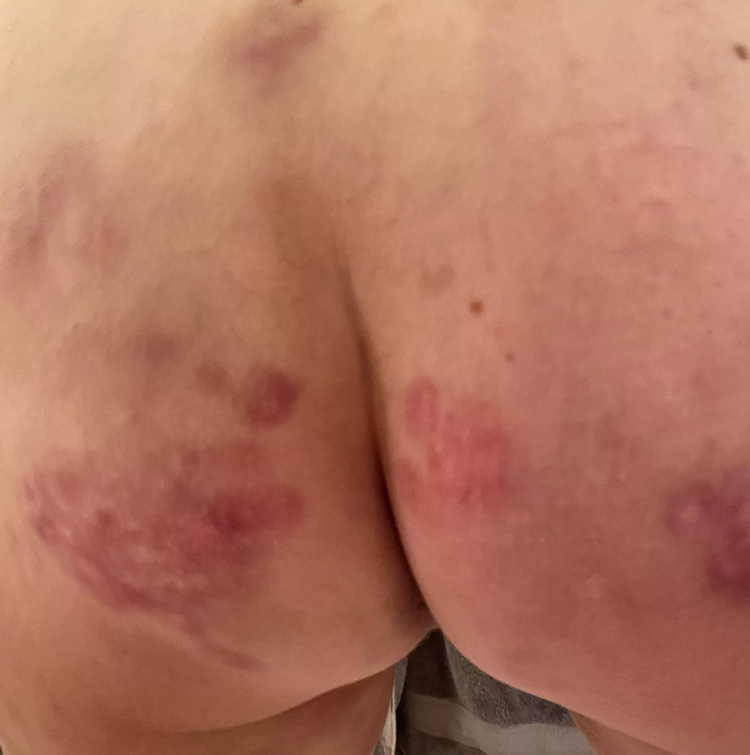 I Love Having Sirs Handprint On My Ass Nudes Spanking Nude Pics Org