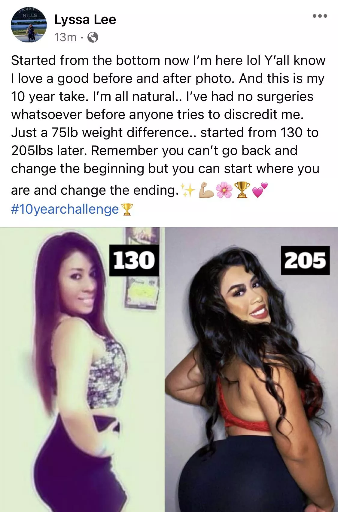 Issa Lyssa Leee Year Challenge Nudes Wgbeforeafter Nude Pics Org