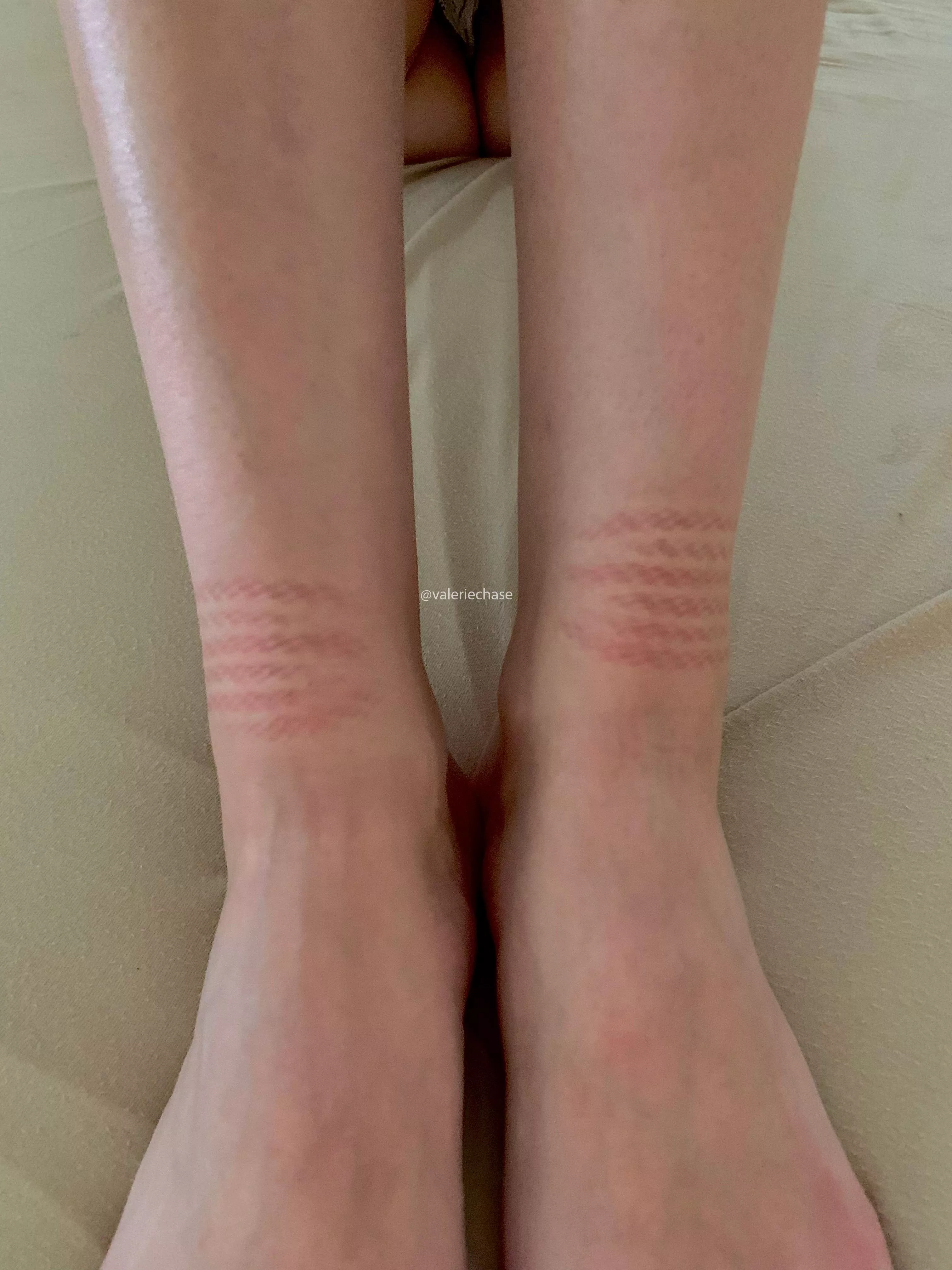 Oc Aftermath From Last Night Nudes Ropebondage Nude Pics Org