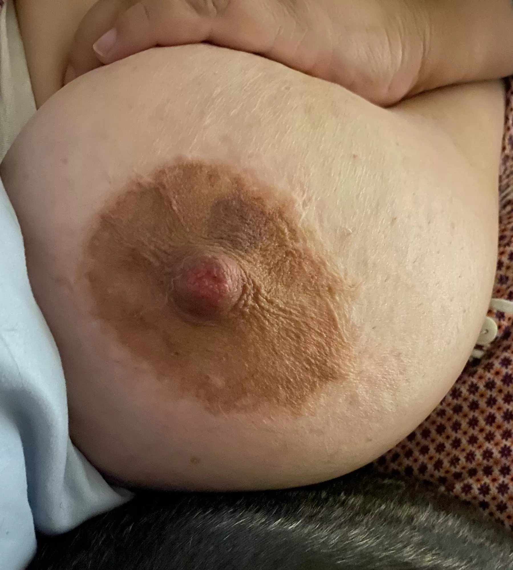 Raw Nipple And Bruised Areolanot Sure If From My Husband Or My Fuck