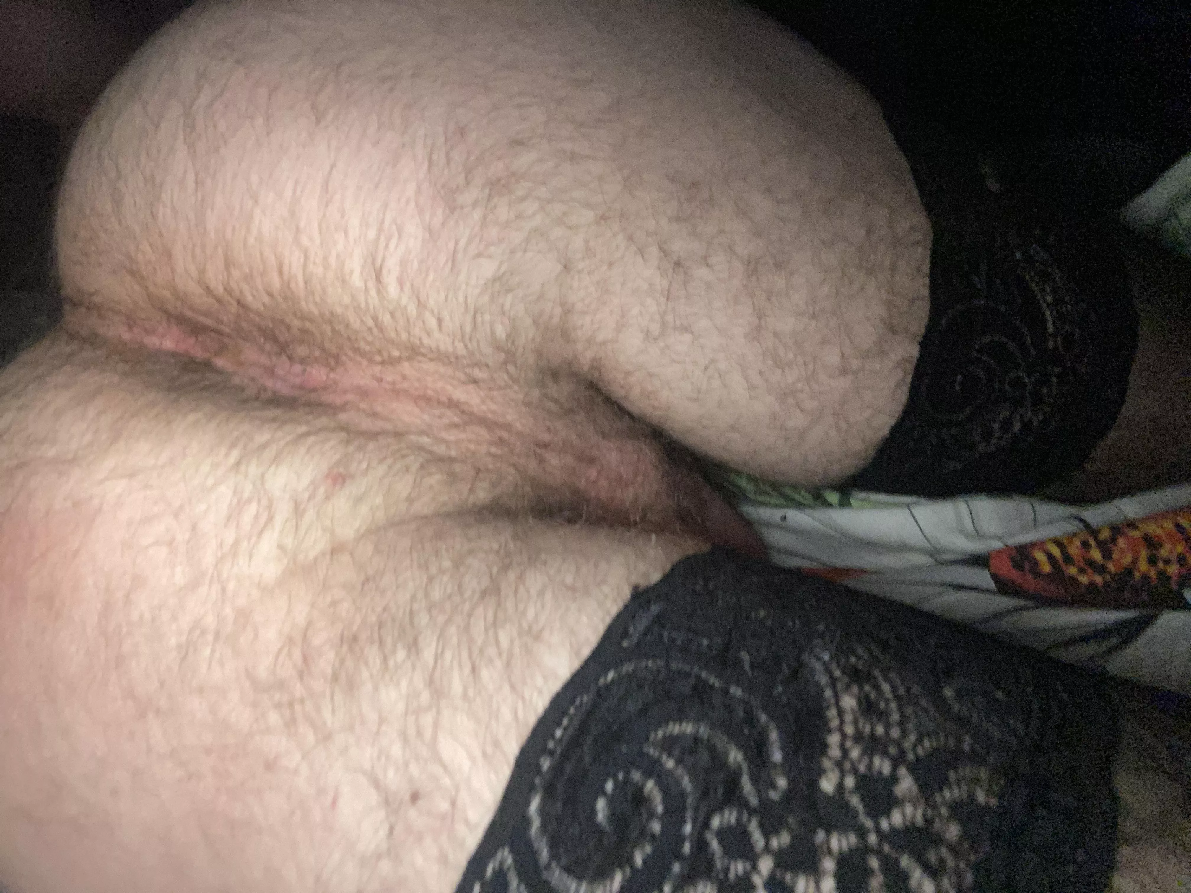 Sup Nudes Hairymanass Nude Pics Org