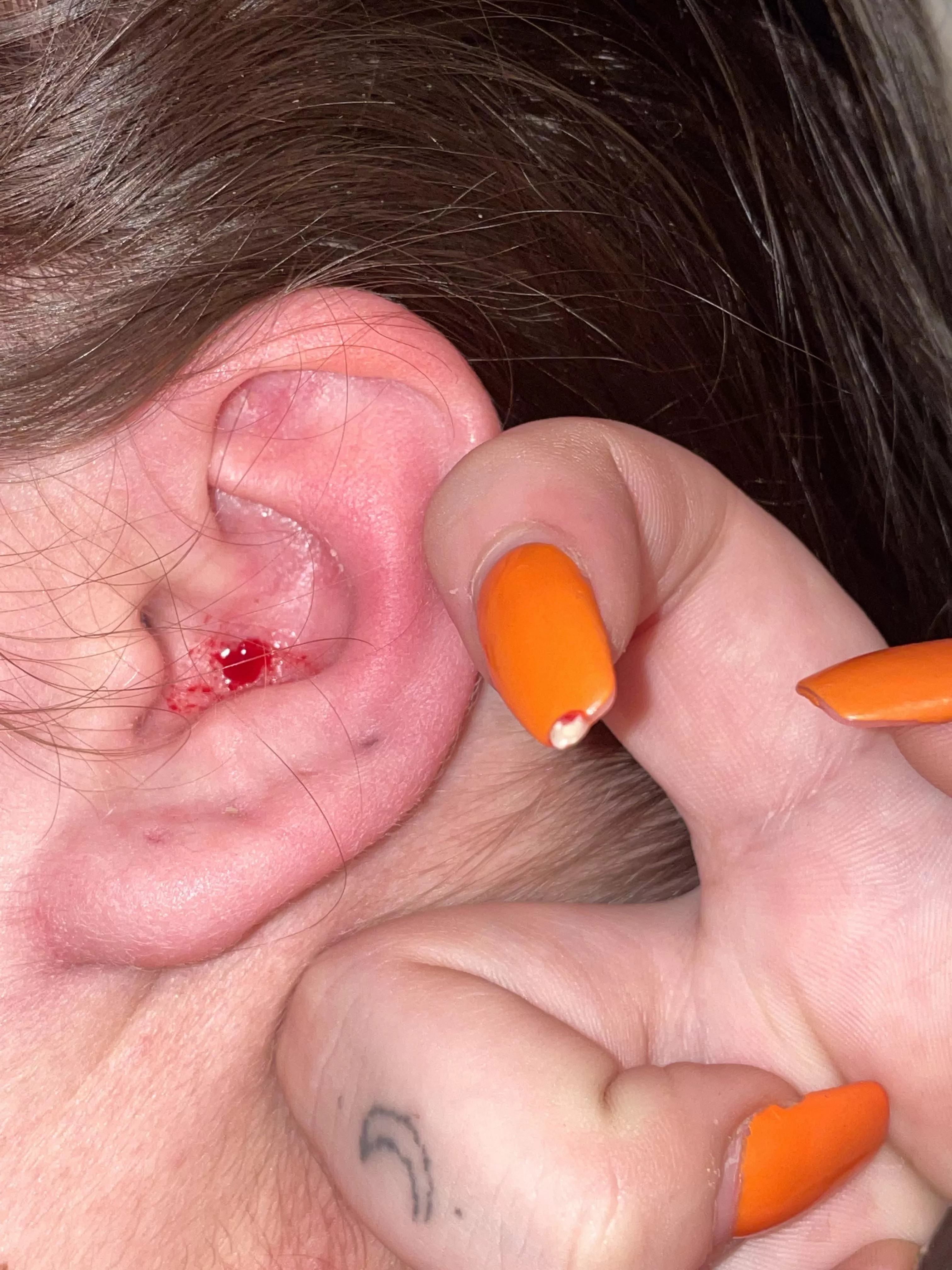 Very Nice Ear Pop But Painful Nudes Popping Nude Pics Org