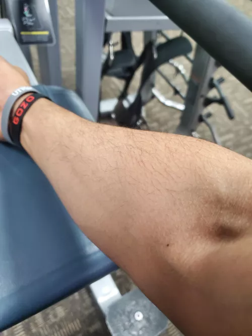 ✌💉 ✌💉