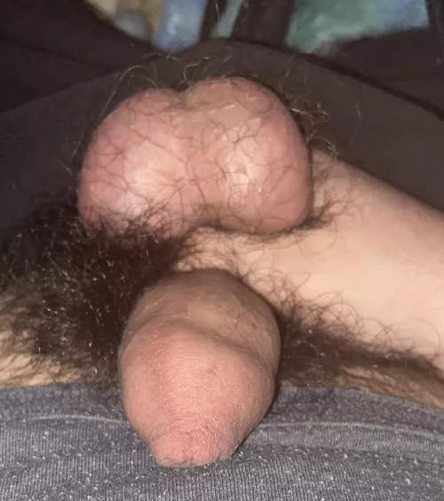 18M hairy balls