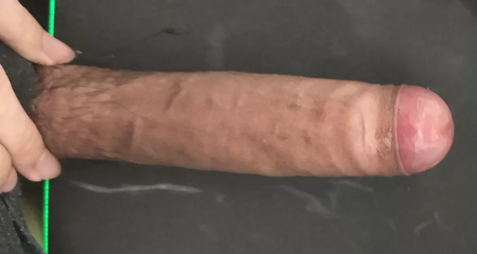 18M, will phimosis scare girls away?