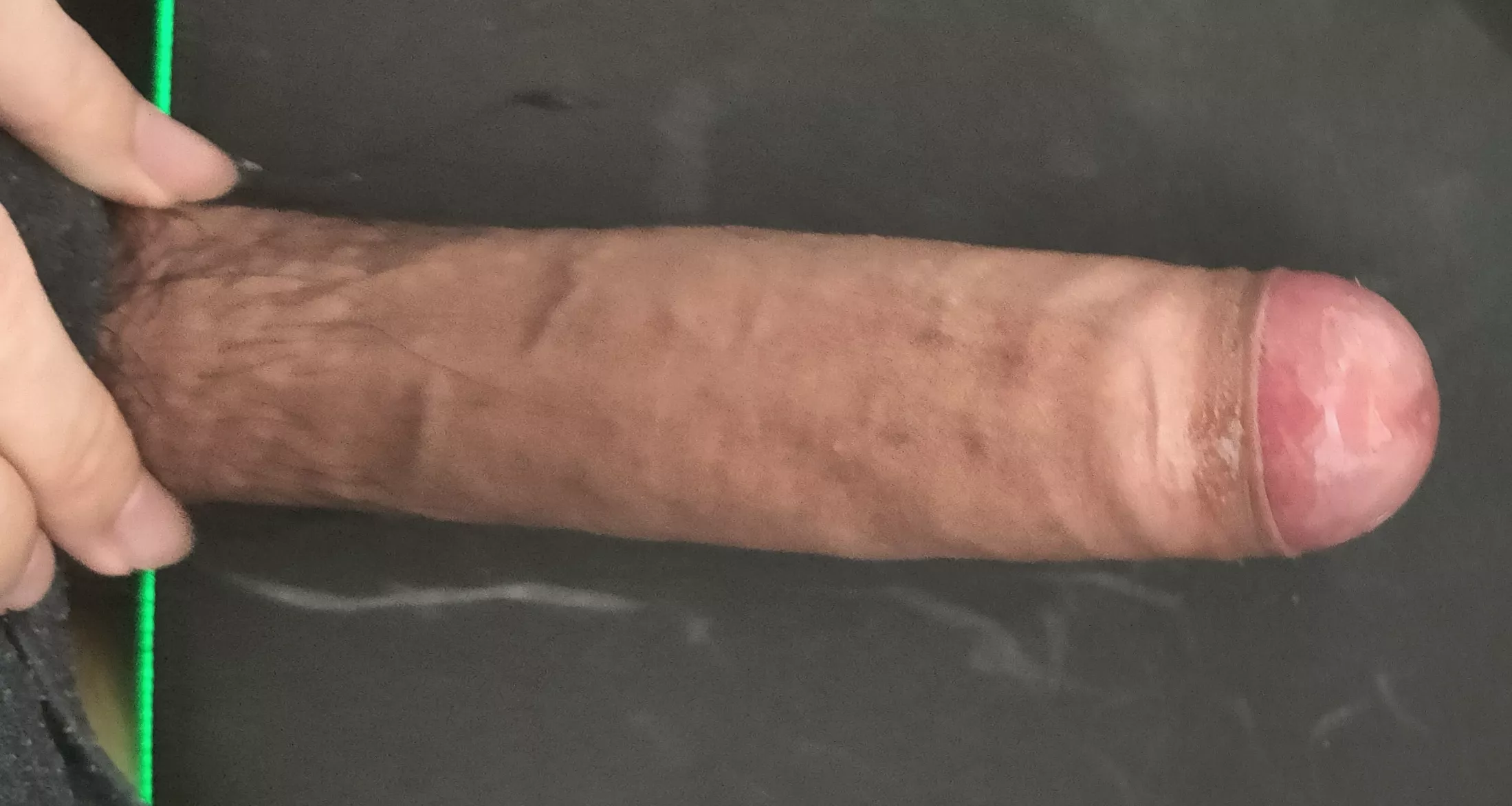 18M, will phimosis scare girls away?