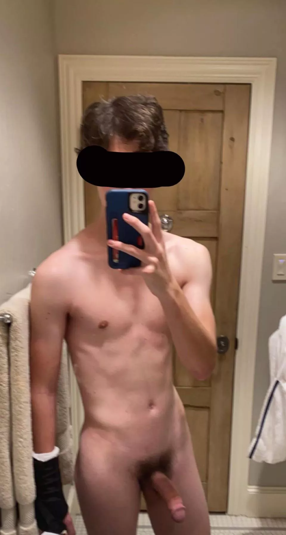 [19M] Wrist surgery today, thought I’d make a quick post! Honest thoughts on the body?
