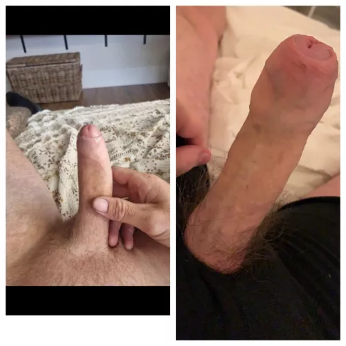 2 uncircumcised pindicks that can't satisfy their girls compared π which is better, left or right pic?