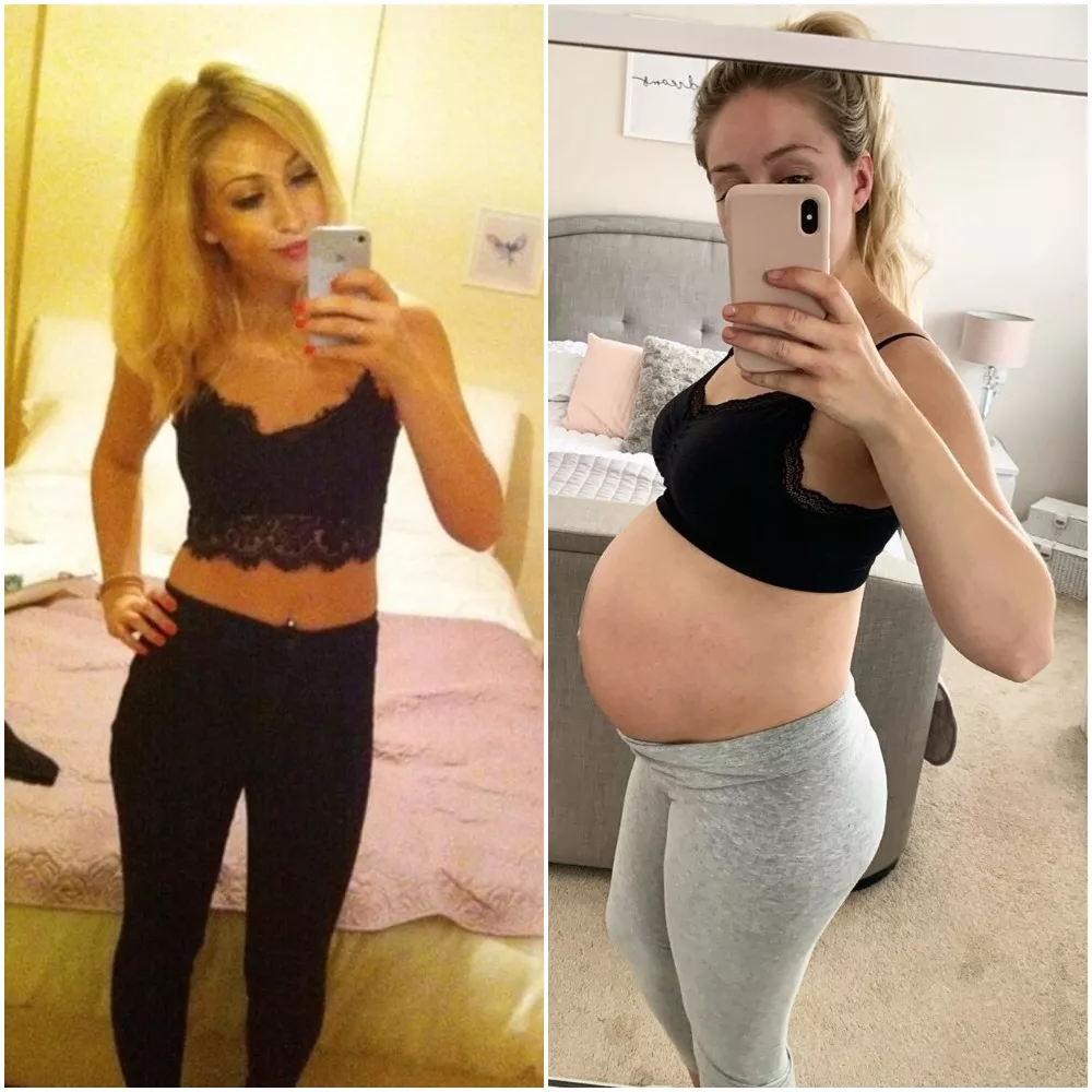 20 vs 25 and pregnant 20 vs 25 and pregnant