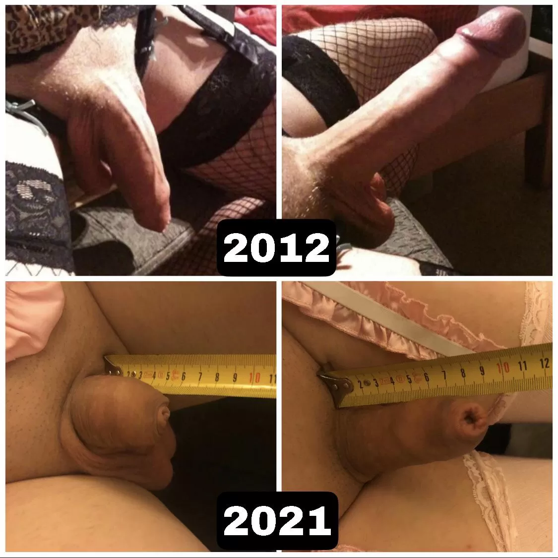 20cm (8 inches) to 9cm (3.5 inches) in 9 years. The result of long term chastity and a sexless relationship. 20cm (8 inches) to 9cm (3.5 inches) in 9 years. The result of long term chastity and a sexless relationship.