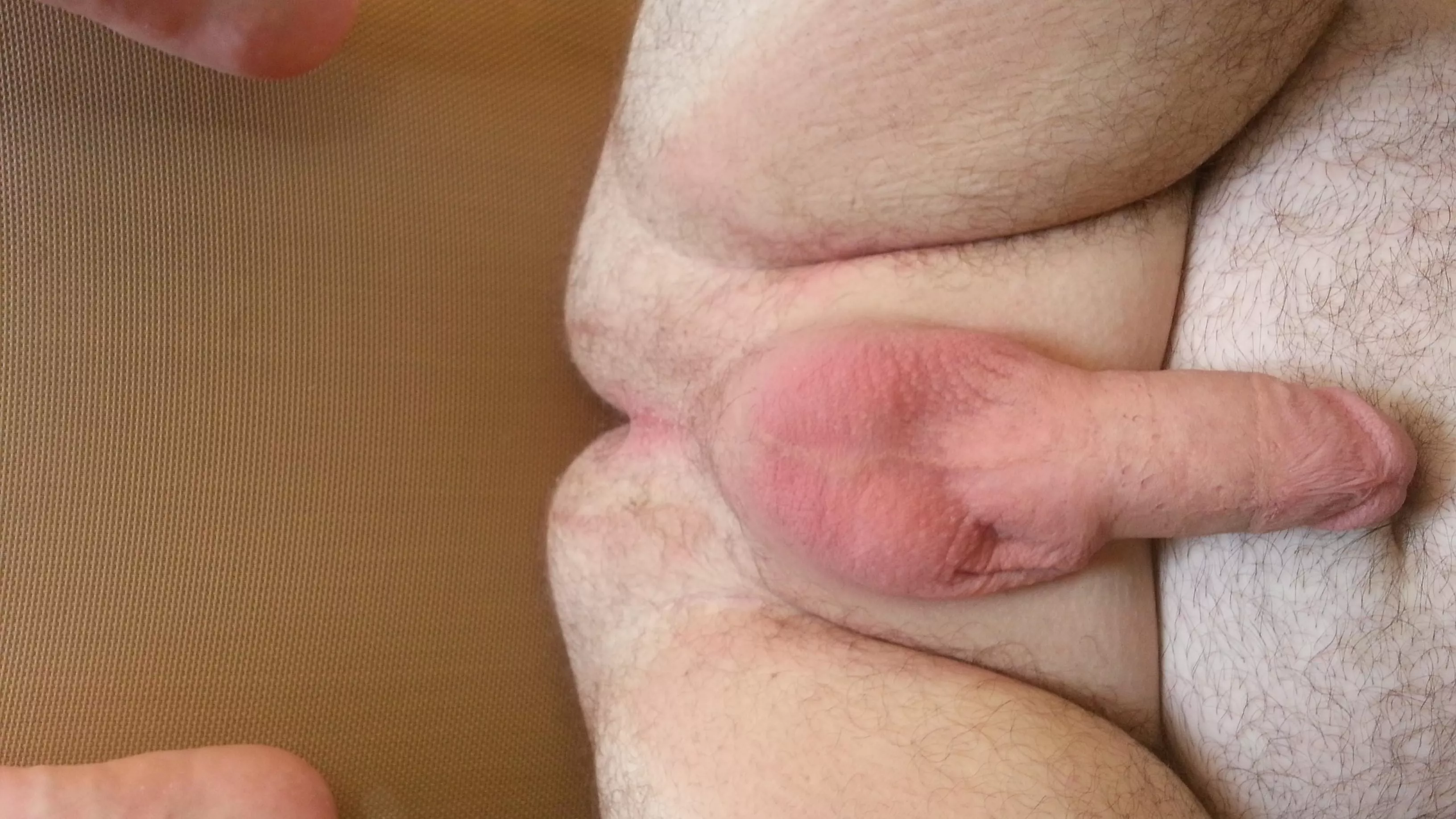 [30] On display for you