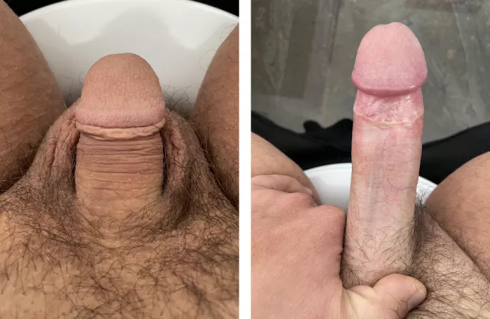 (31) that grow up so fast π³