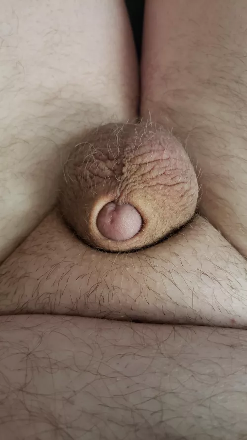 [33] Just a tiny one