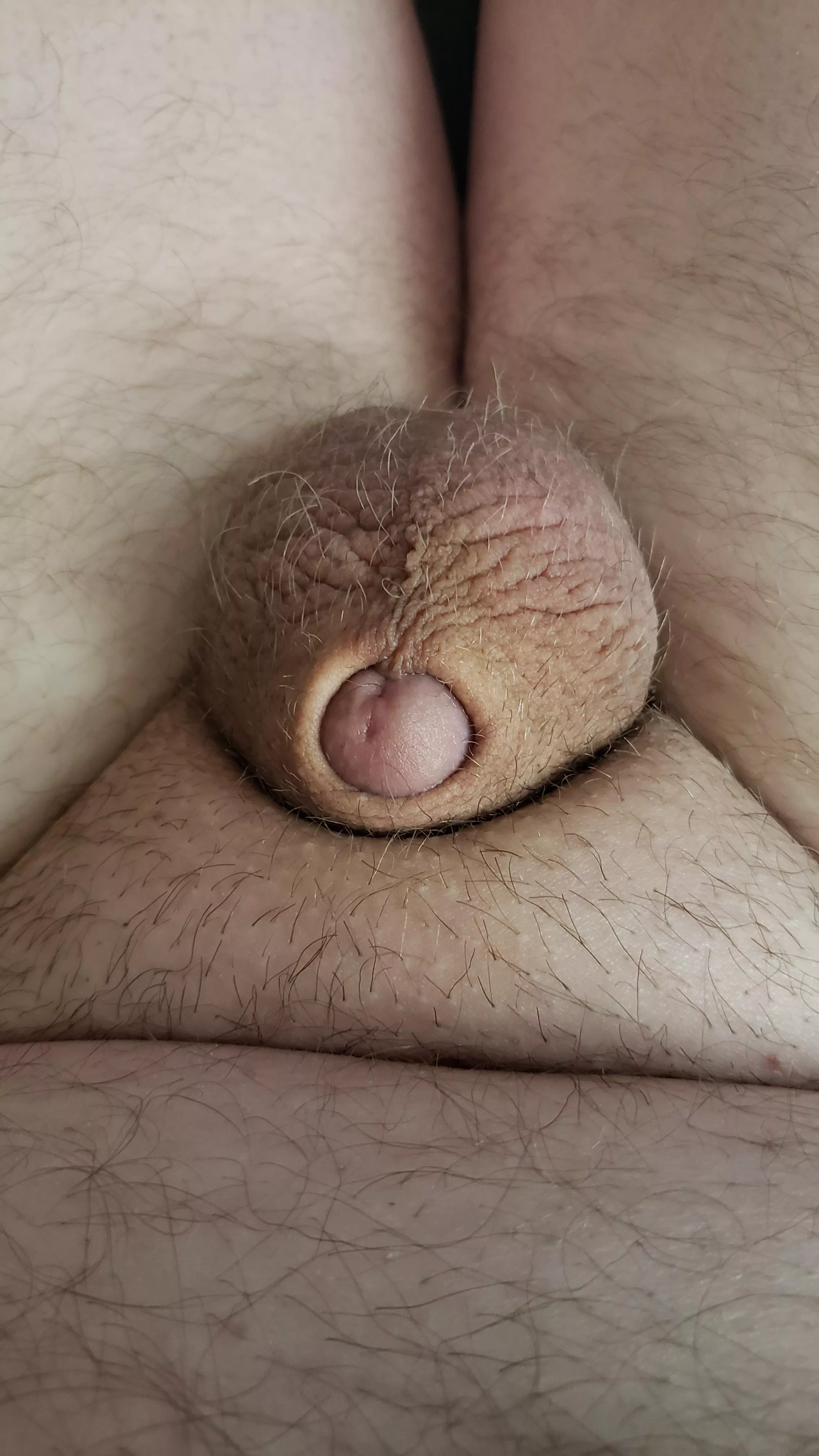 [33] Just a tiny one