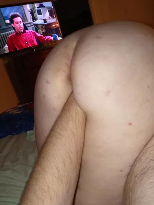 35(f) where did his hand go 35(f) where did his hand go