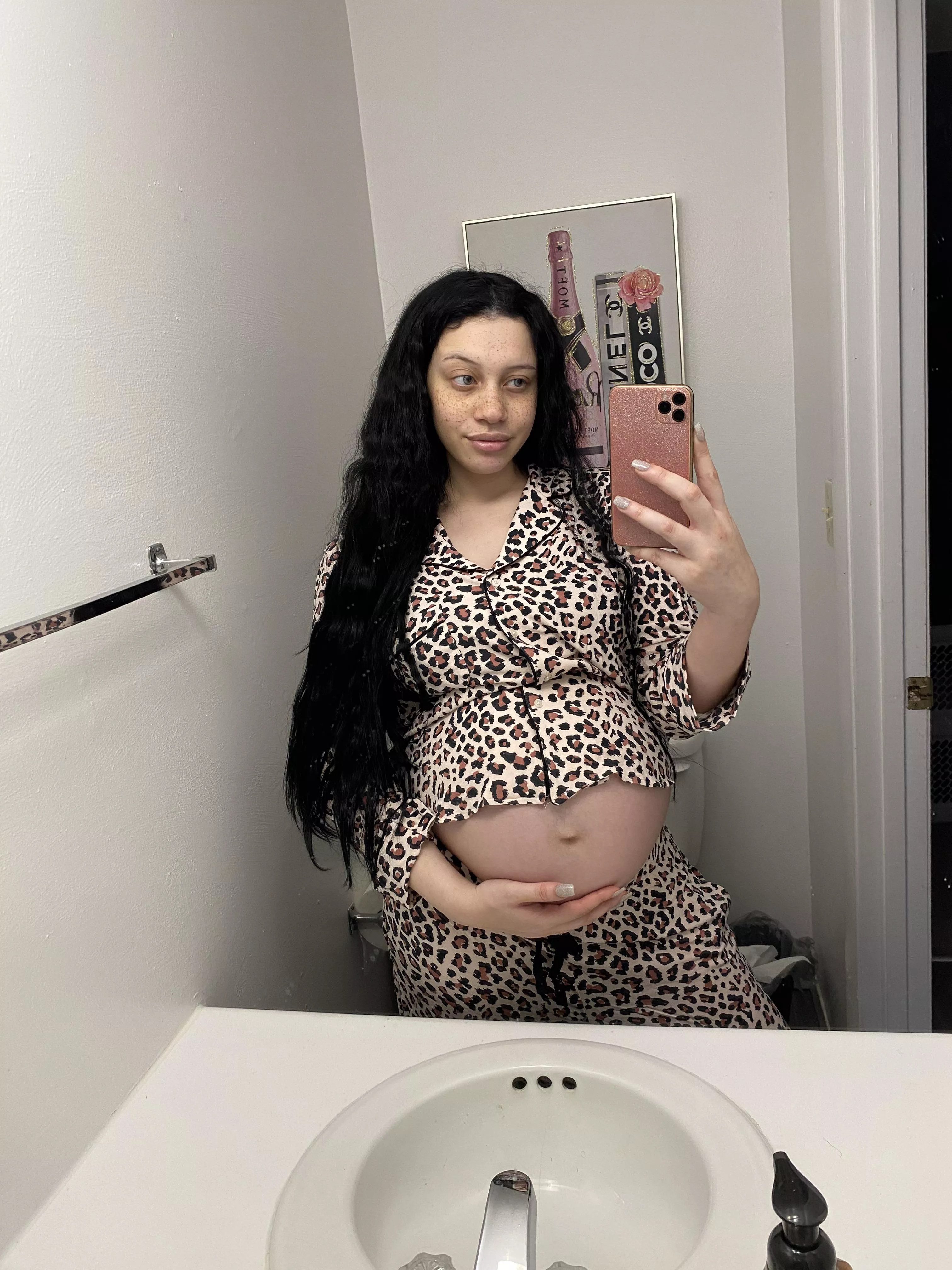 38 неделя беременности чешется грудь фото 28