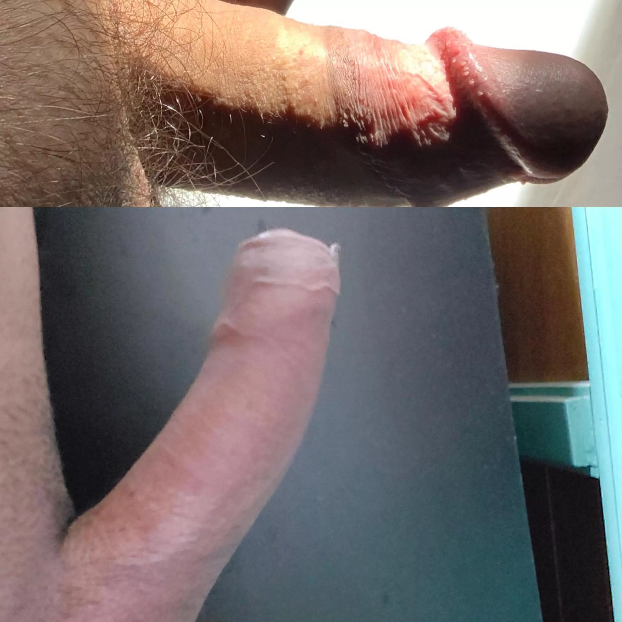 A Battle of the Little Dinks! Me vs u/mmadrug! Who Has the Better Dinky!? A Battle of the Little Dinks! Me vs u/mmadrug! Who Has the Better Dinky!?