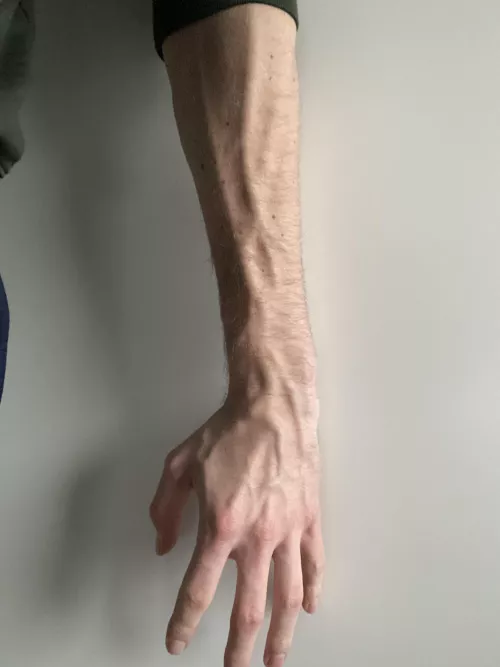 A bit of forearm and hand A bit of forearm and hand