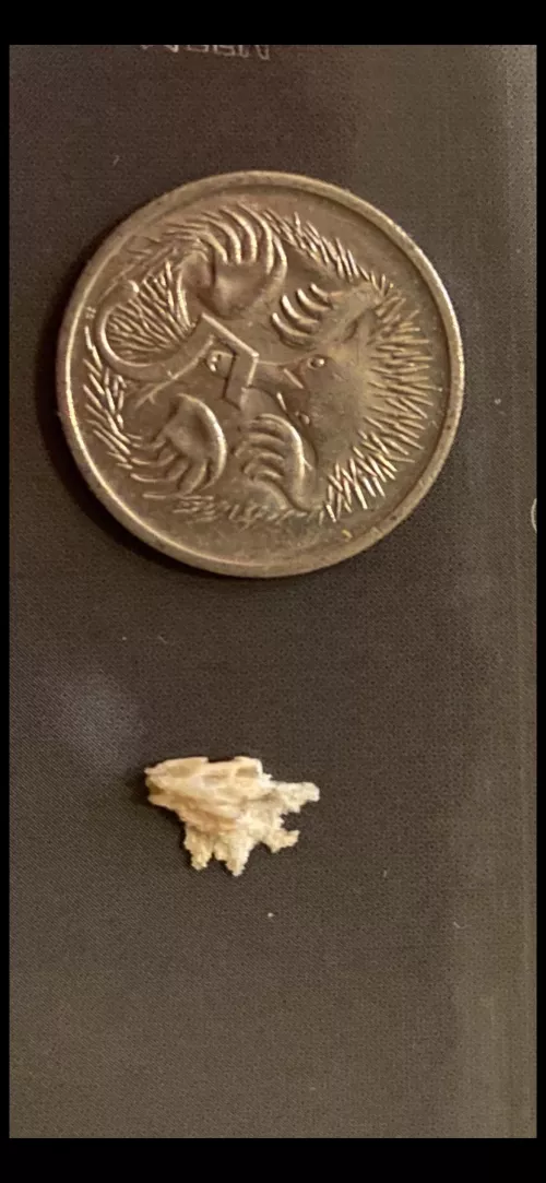 A Bone Shard fragment that came through gum following wisdom tooth removal. More detail in comments. A Bone Shard fragment that came through gum following wisdom tooth removal. More detail in comments.