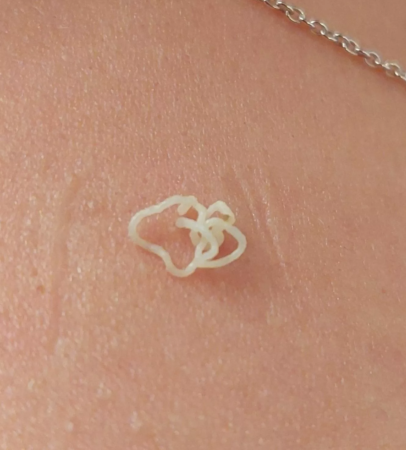 A little thing on my wife's shoulder.