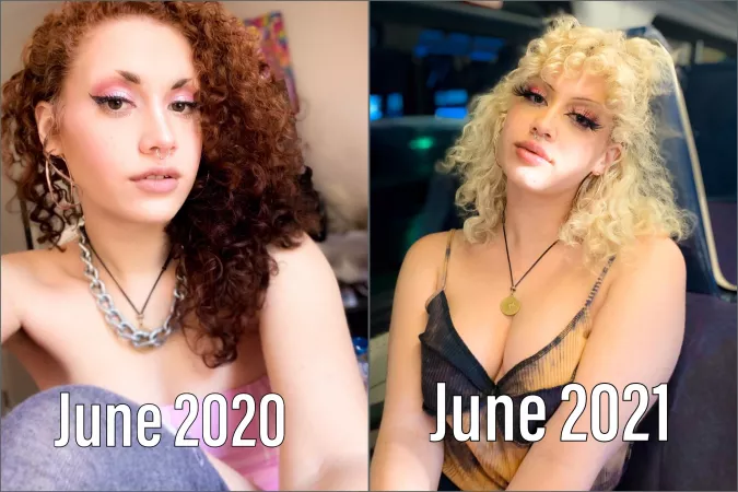 A year of difference ๐ hair, lips, and botox! Already have an appointment for another ml of filler for my lips