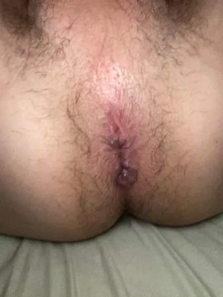 After my boyfriend fucked me hard π