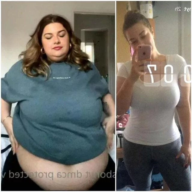 Aliss Bonython S Weight Gain Before And After Nudes Wgbeforeafter