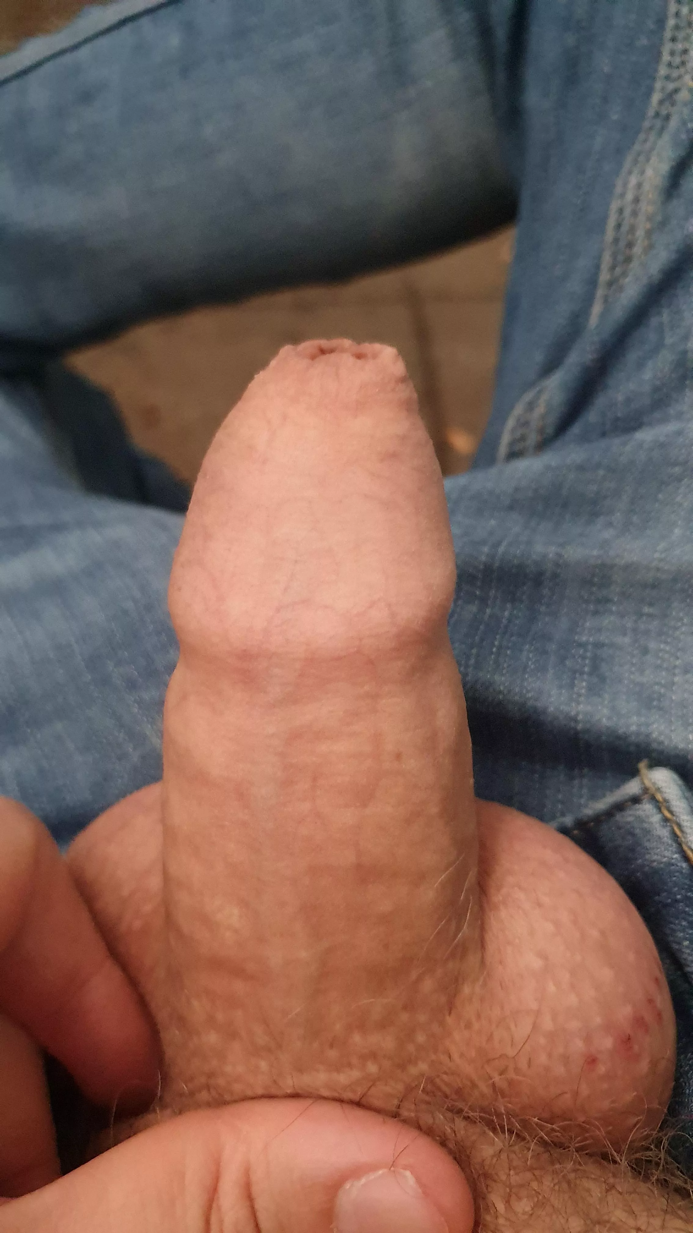 All covered All covered