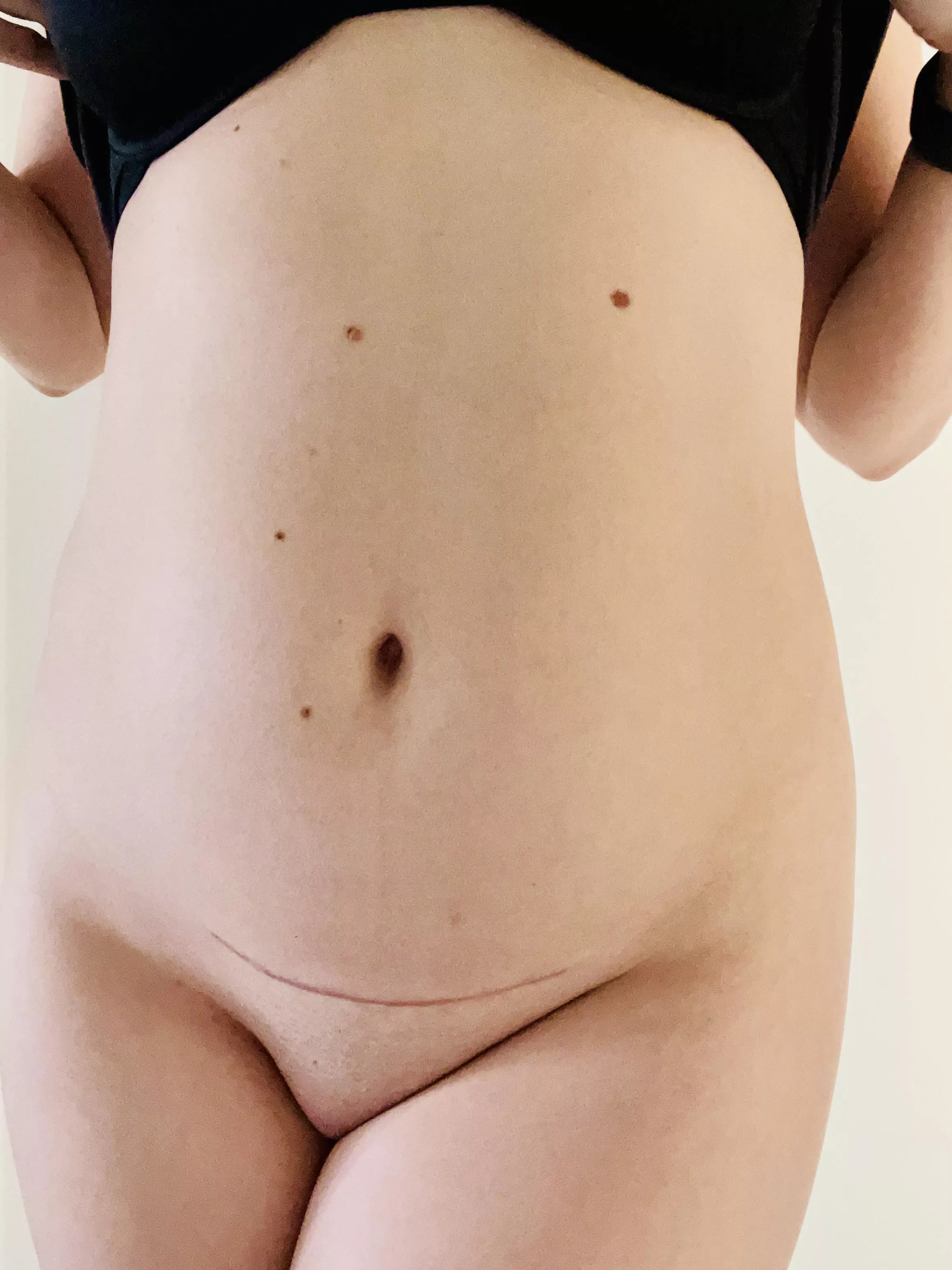 Am I still sexy?? 2 months after CSection