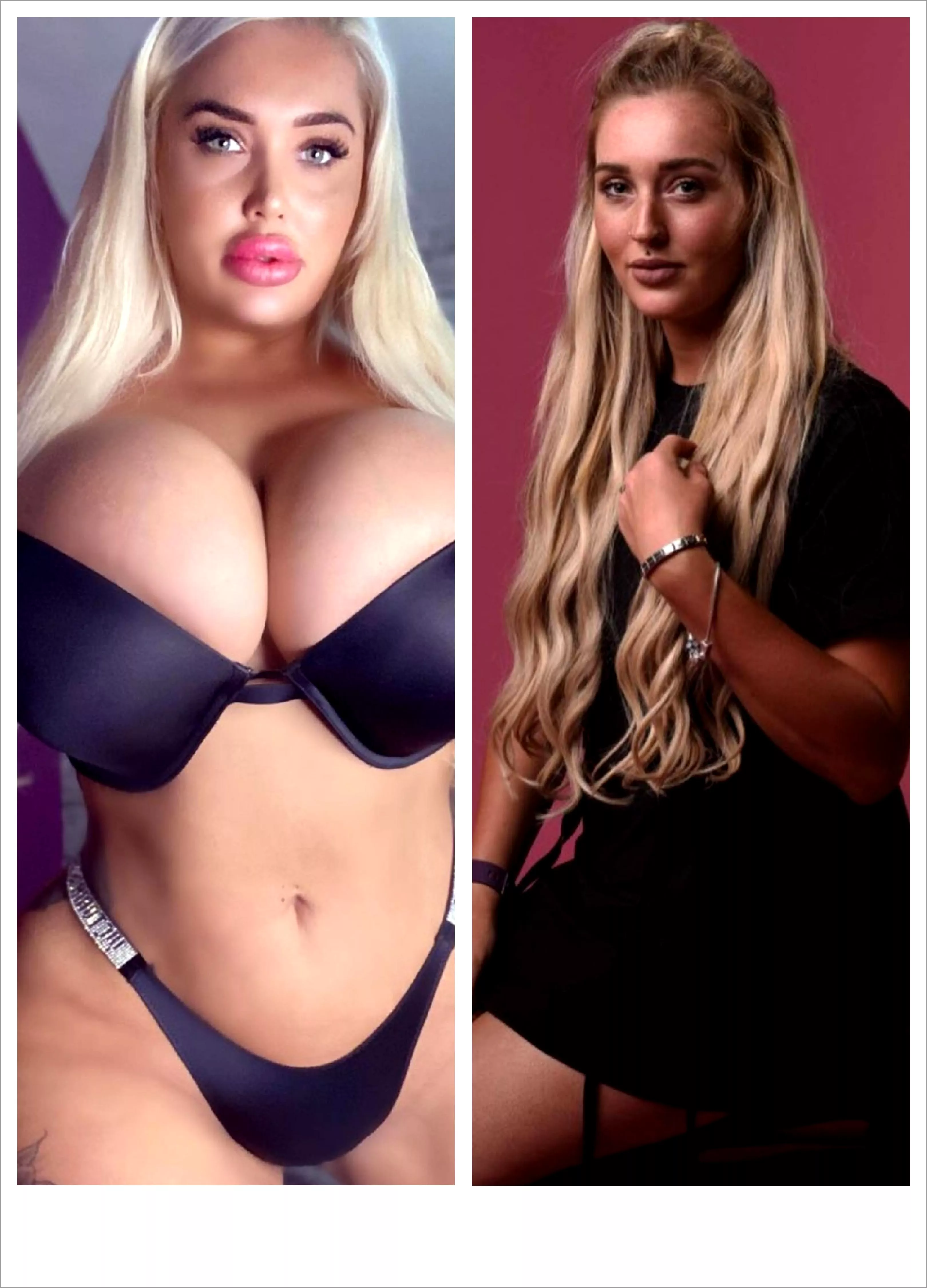 Amber Mwy rapid progression Amber Mwy rapid progression