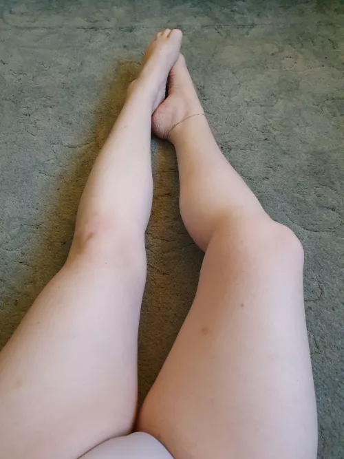 Anklets and bruises make wonderful accessories!