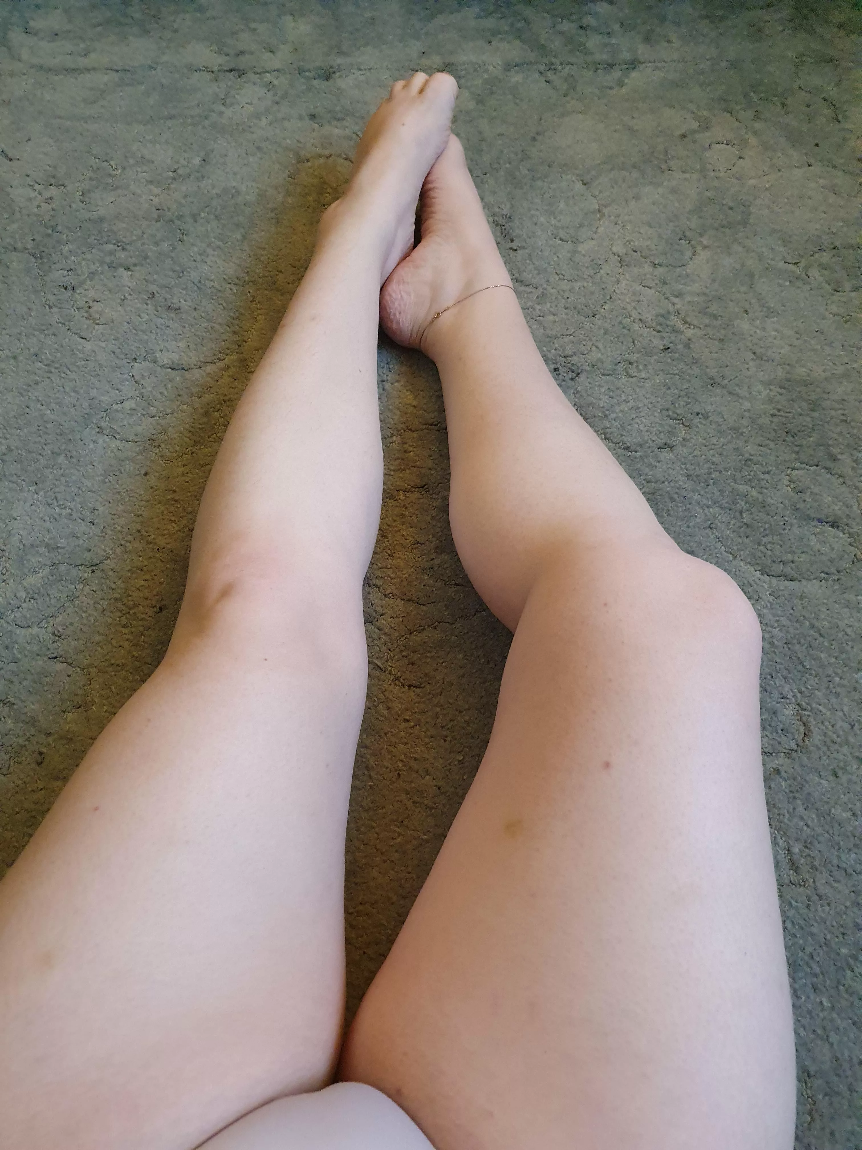 Anklets and bruises make wonderful accessories! Anklets and bruises make wonderful accessories!