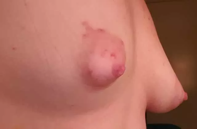 Another angle of my uneven boobs [23f, 126, 5'6]