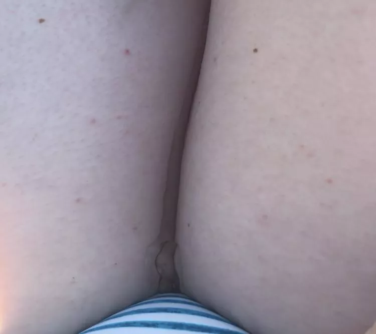 Another hot pic of me peeing myself on a pool chair ??