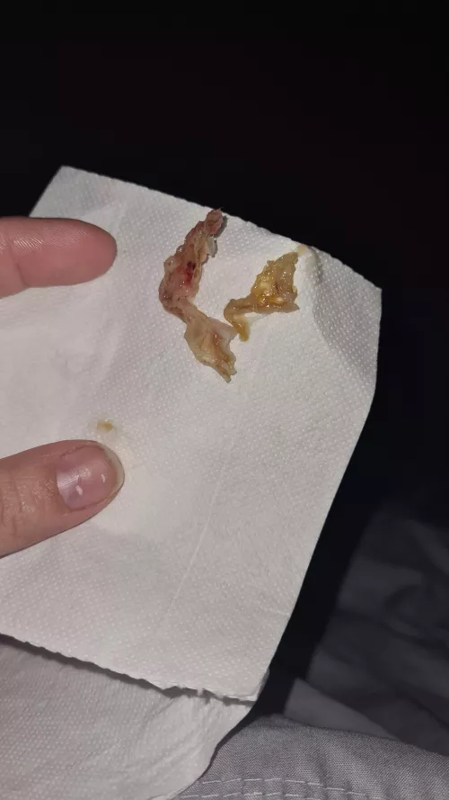 Another juicy nose blow last night