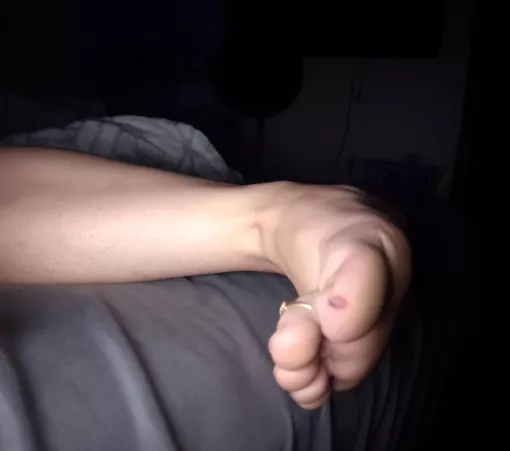 Anyone here good at kissing boo boos?π’