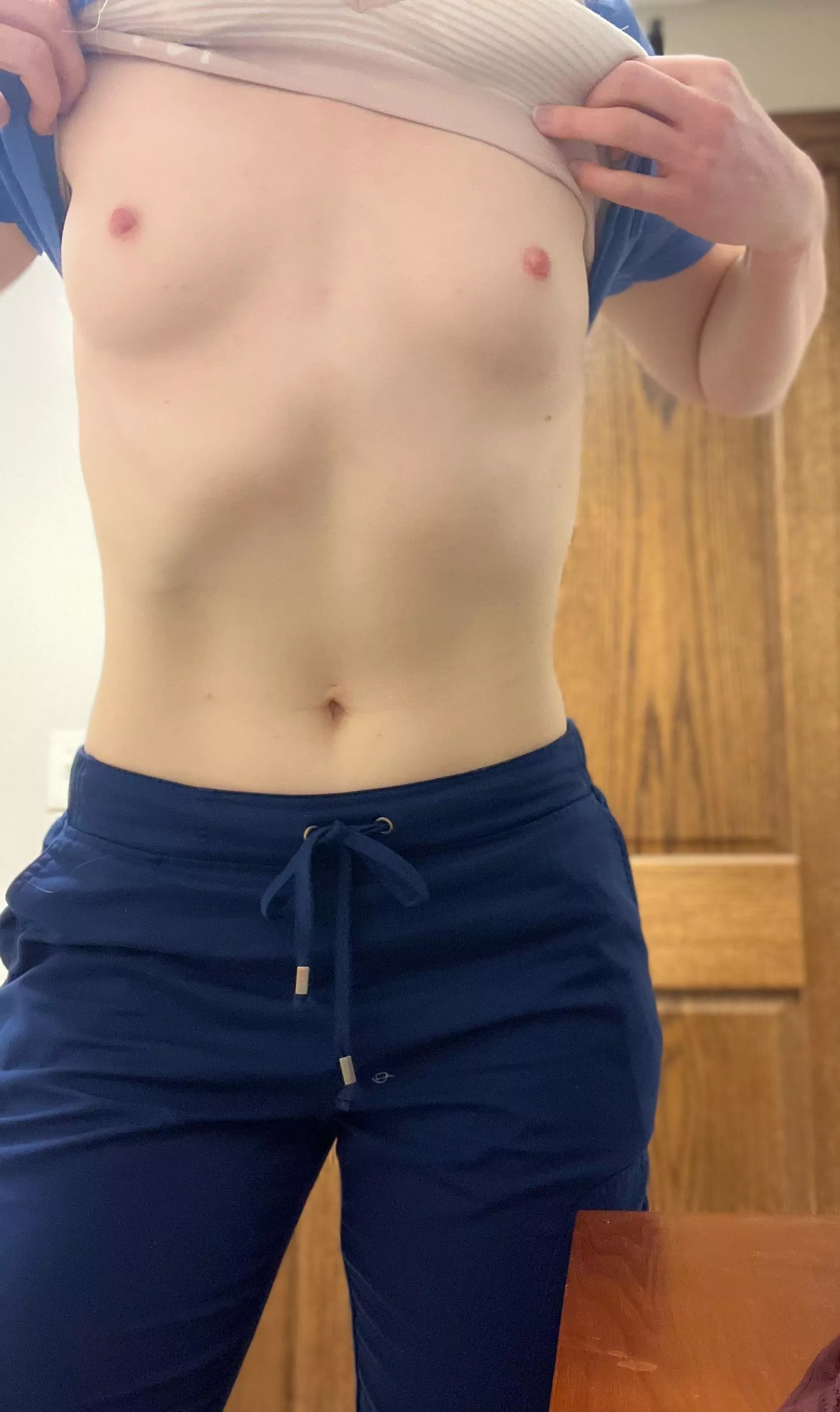 Anyone here have a thing for topless healthcare workers? (F)