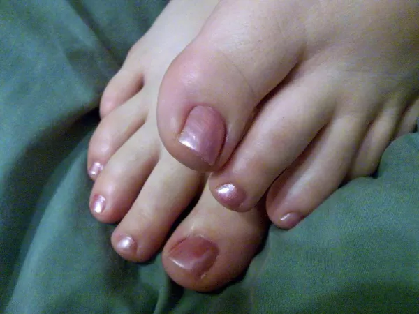 Anyone keen for a serve of my wifeโs sexy little toes? ๐๐คค๐