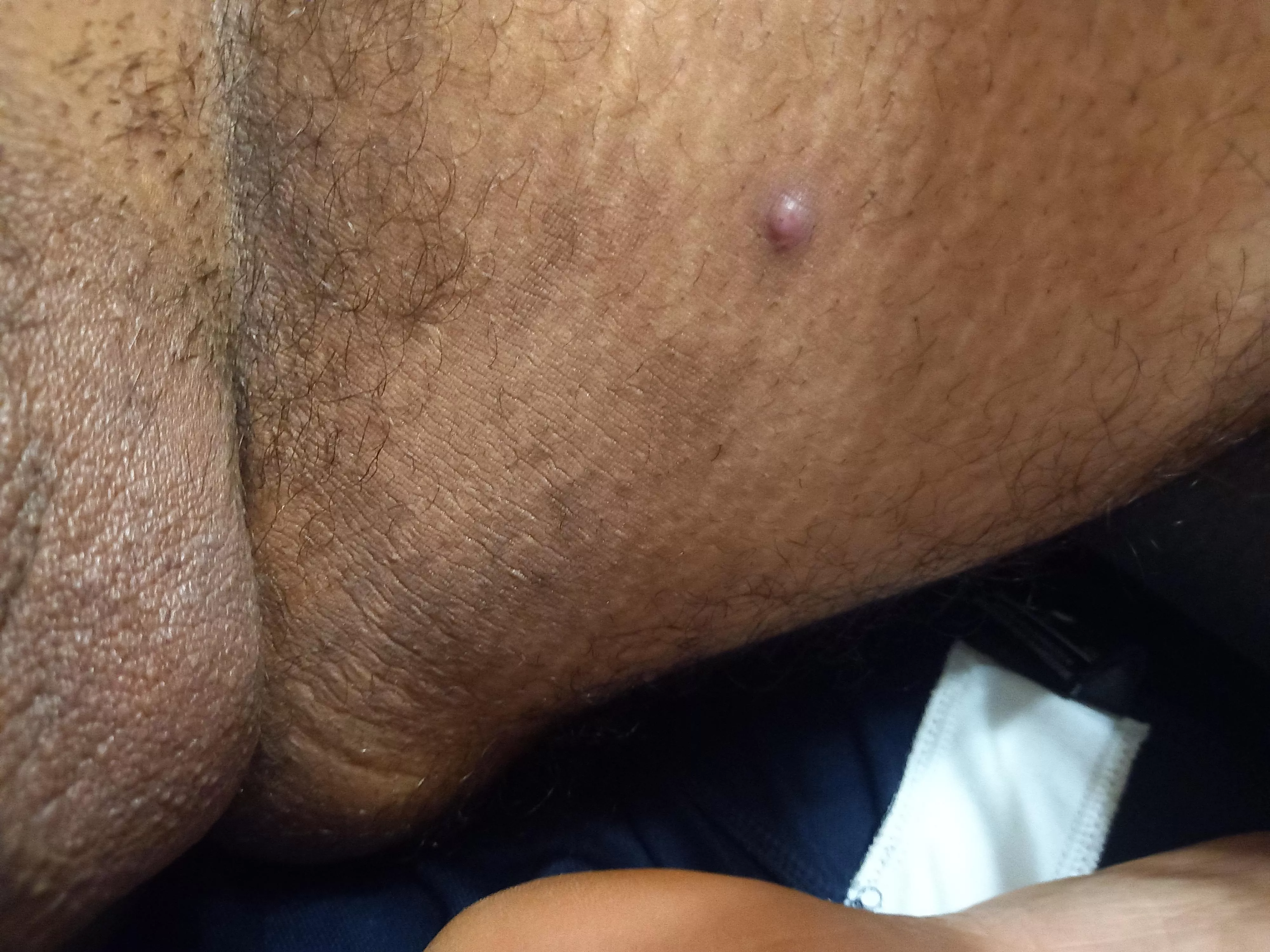 Anyone knows what this spot is, it hurts when I touch it. Anyone knows what this spot is, it hurts when I touch it.