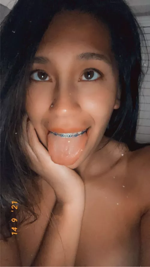 Anyone like braces?? Anyone like braces??