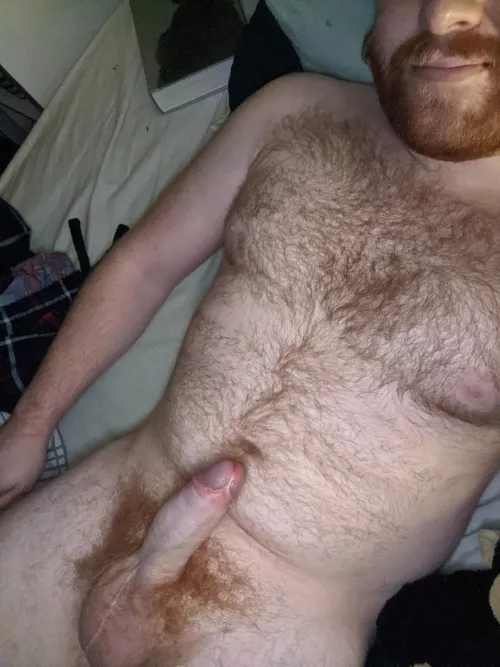 Anyone wanna tend to my fire crotch?