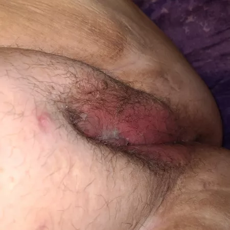 Anyone want to add another load or 5 to my creamed pussy? 35(F) Anyone want to add another load or 5 to my creamed pussy? 35(F)