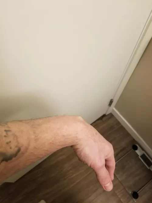 Baby ganglion. Havent decided if I want to smack him with a book or not yet.