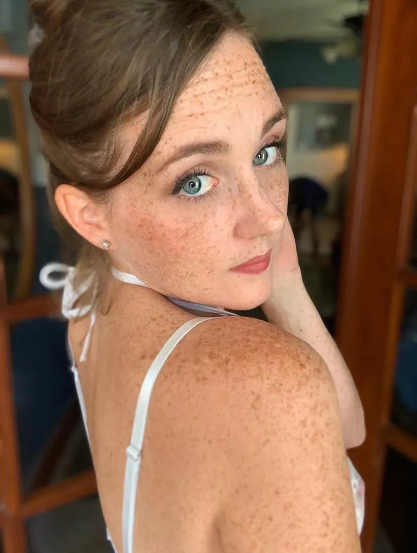 Back freckles 😍