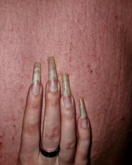 Back scratching with natural nails ππ₯
