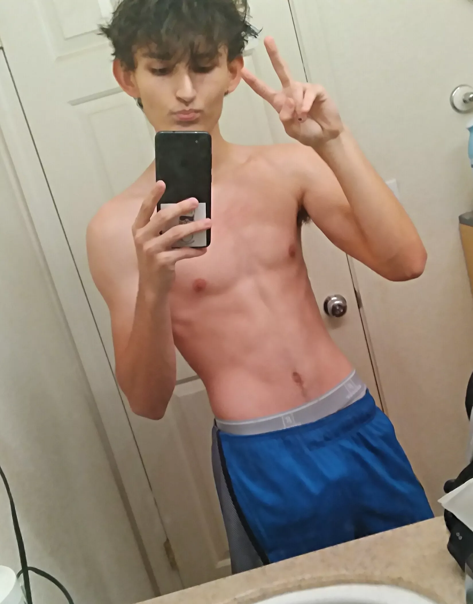 Been pretty self conscious and haven't posted lately cause of it. Hope you guys are doing okay :3