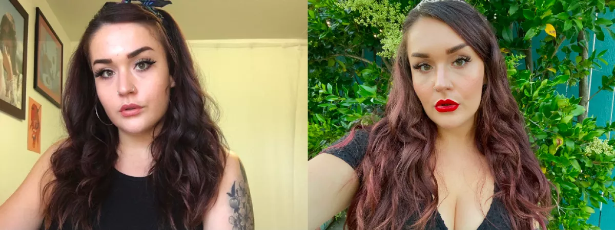 Before & after 40 units of Botox in my jaw π€© 1st round of lip filler to come in the next month or so!