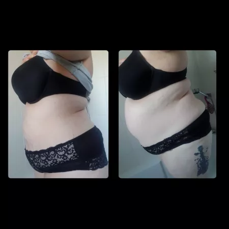 Before and After of another 4L enema Before and After of another 4L enema