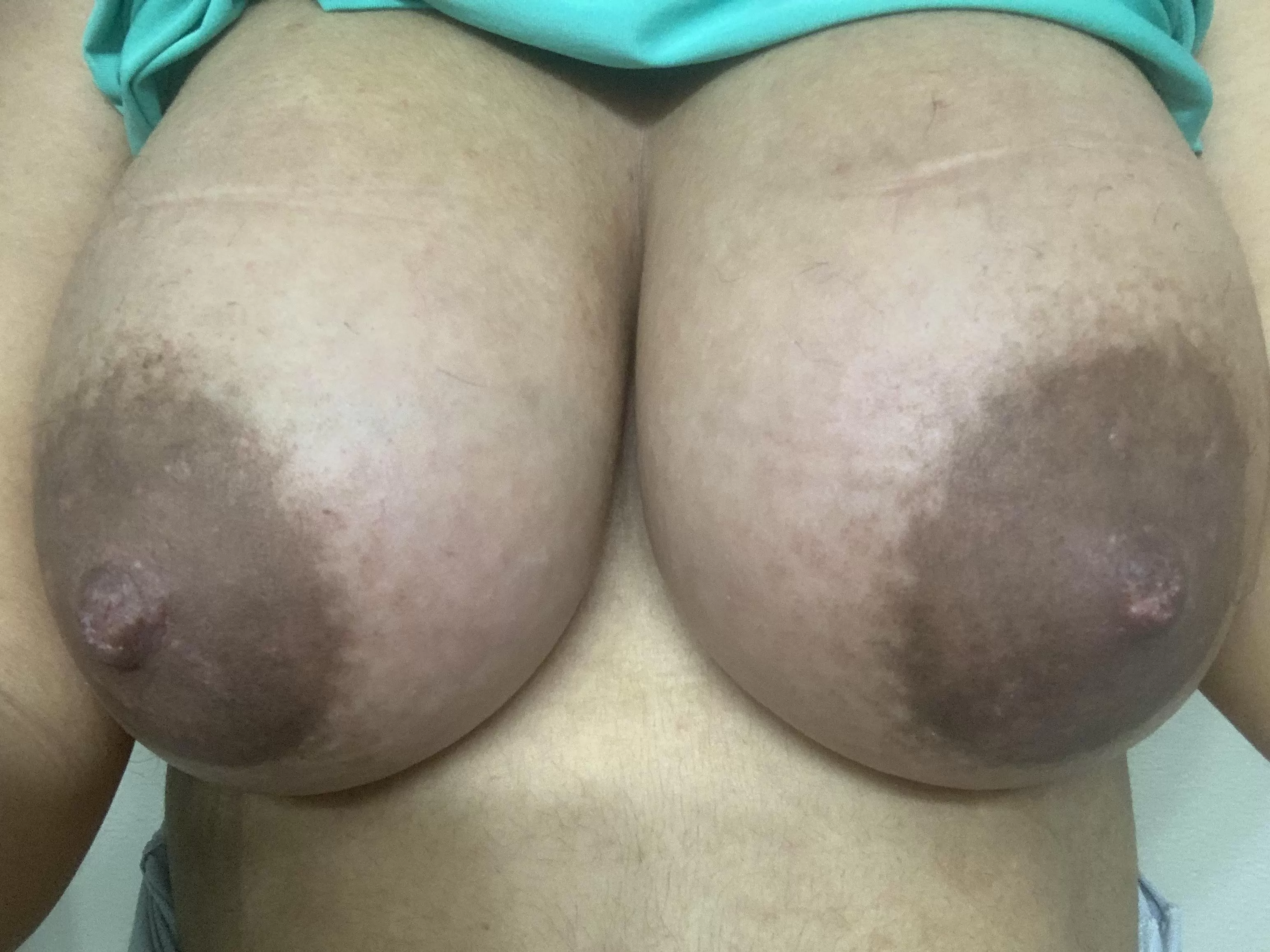Pregnant tits pics
